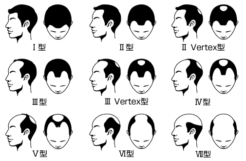 AGA進行判定指標